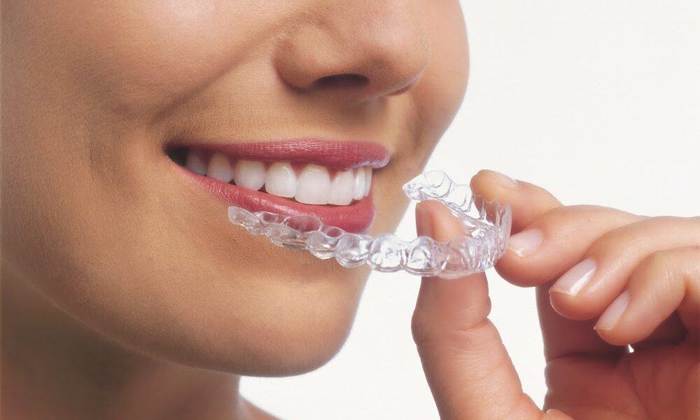 Orthodontic Center LA